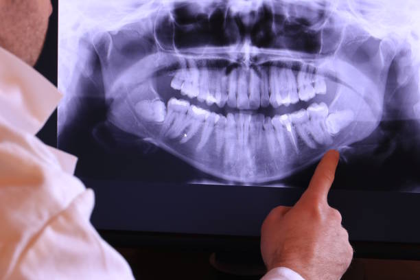 Best Urgent Care for Lost Fillings or Crowns in North Adams, MA