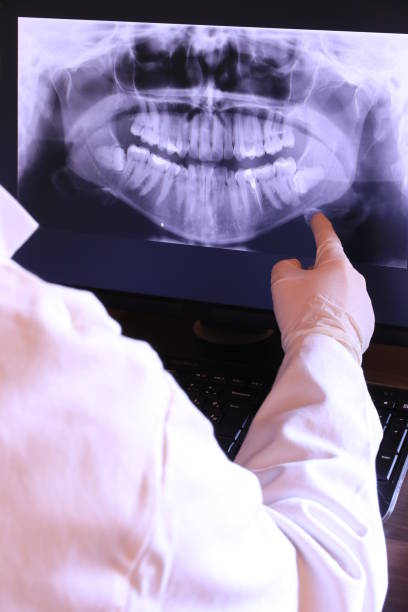 Best Emergency Wisdom Teeth Removal in North Adams, MA