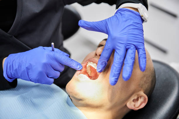 Best Emergency Treatment for Dental Infections or Abscesses in North Adams, MA